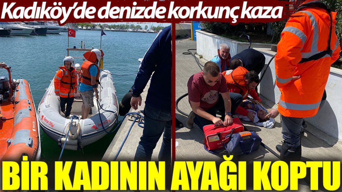 Kadıköy’de denizde korkunç kaza: Bir kadının ayağı koptu