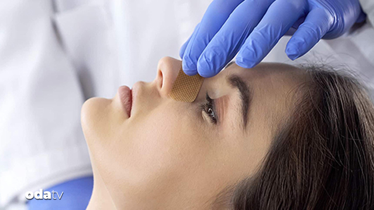 bakanliktan burun ameliyatlarina emsal karar JuBR4UAb